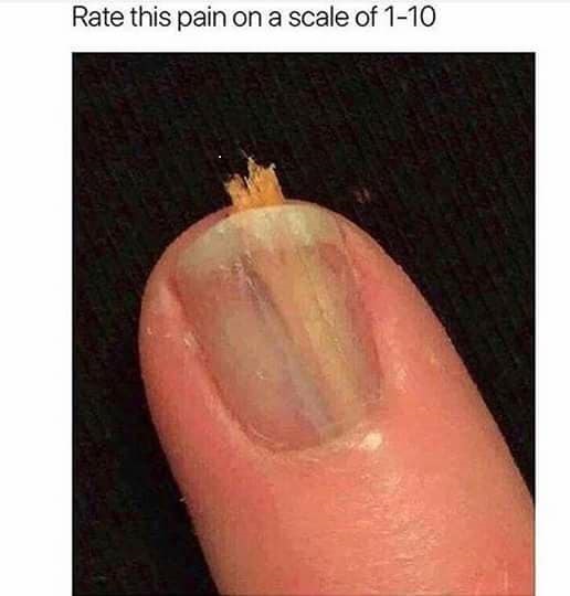 Splinter under fingernail